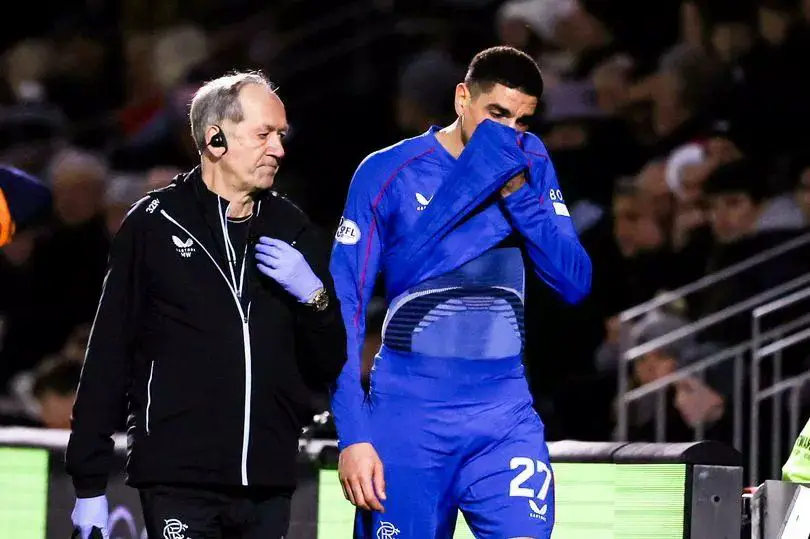 Écosse : Incertitude autour de Balogun avant un choc crucial